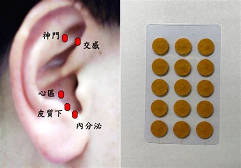 耳穴貼是什麼|耳穴療法功效｜中醫教你按壓技巧改頭痛、失眠等10大 